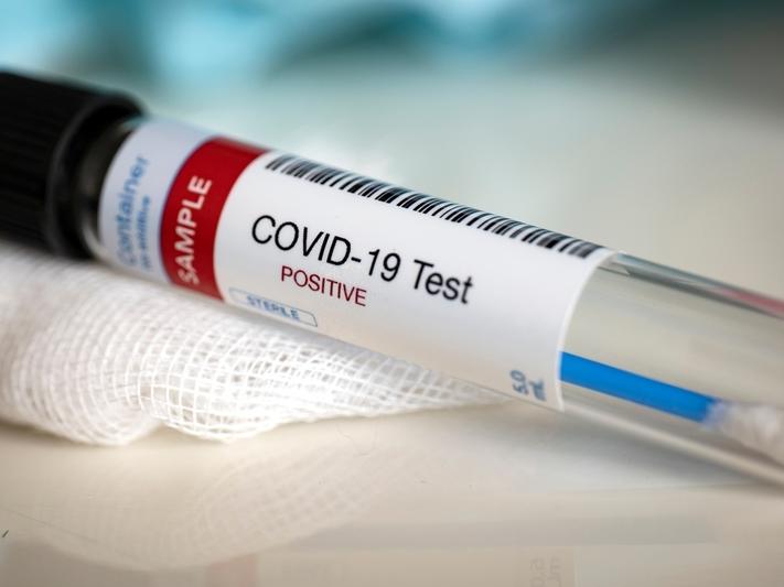 No need to test the asymptomatic people